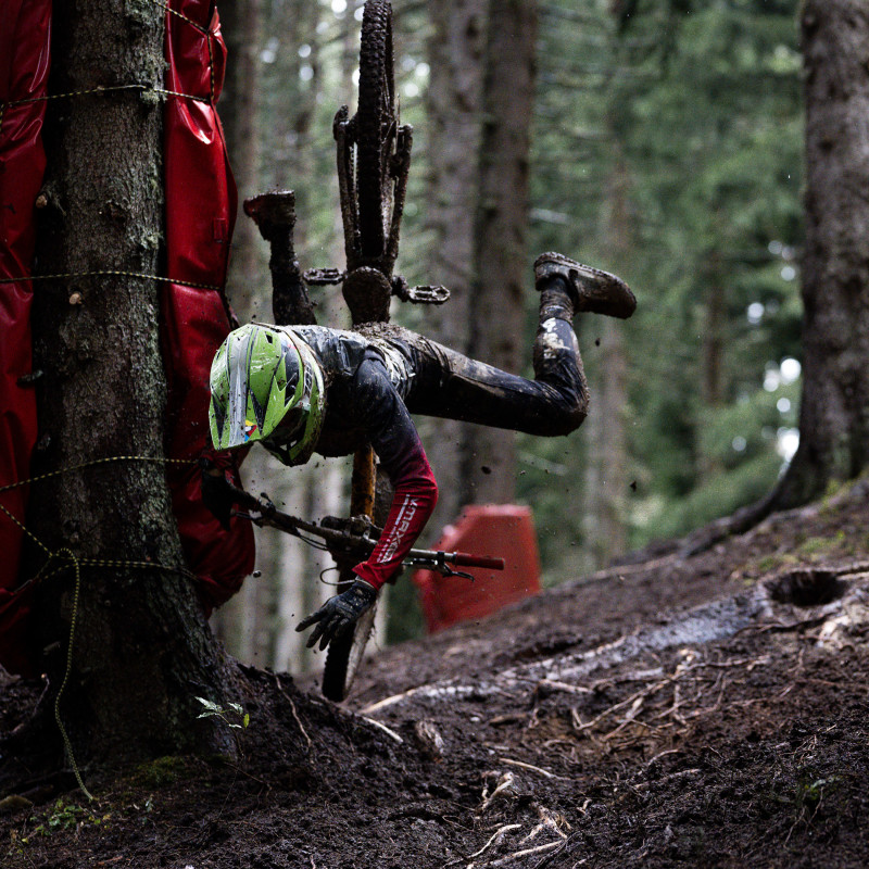 5 פציעות ה-MTB הנפוצות ביותר, על פי רוכבים שלמדו בדרך הקשה